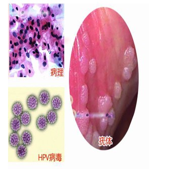 ���Լ���ʪ���֢״